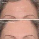 Murad Targeted Wrinkle Corrector tuote 15 ml