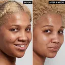 The Inkey List Niacinamide Serum 30 ml