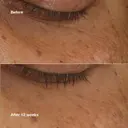 Clinique All About Eyes Brightening Serum Concentrate silmänympärysseerumi 10 ml