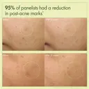 Origins Dr. Weil Mega-Mushroom Dark Spot Brightening Moisturizer -kosteusvoide 50 ml