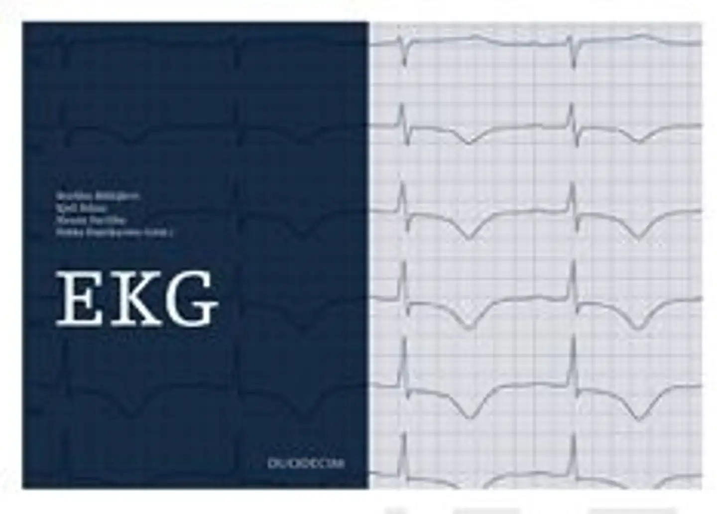 EKG