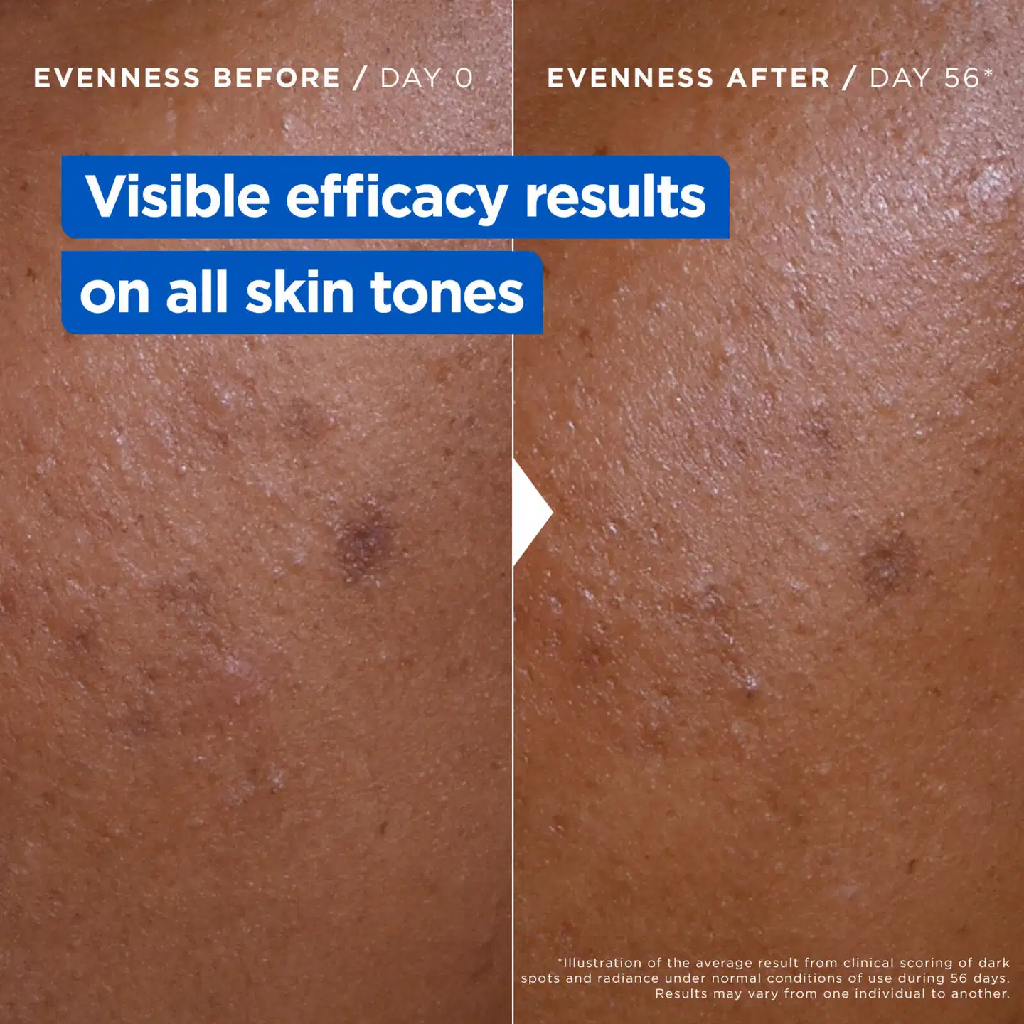 Mixa Niacinamide Bright Ravitseva voide tummia läiskiä vastaan, erittäin kuivalle iholle 400ml - 3