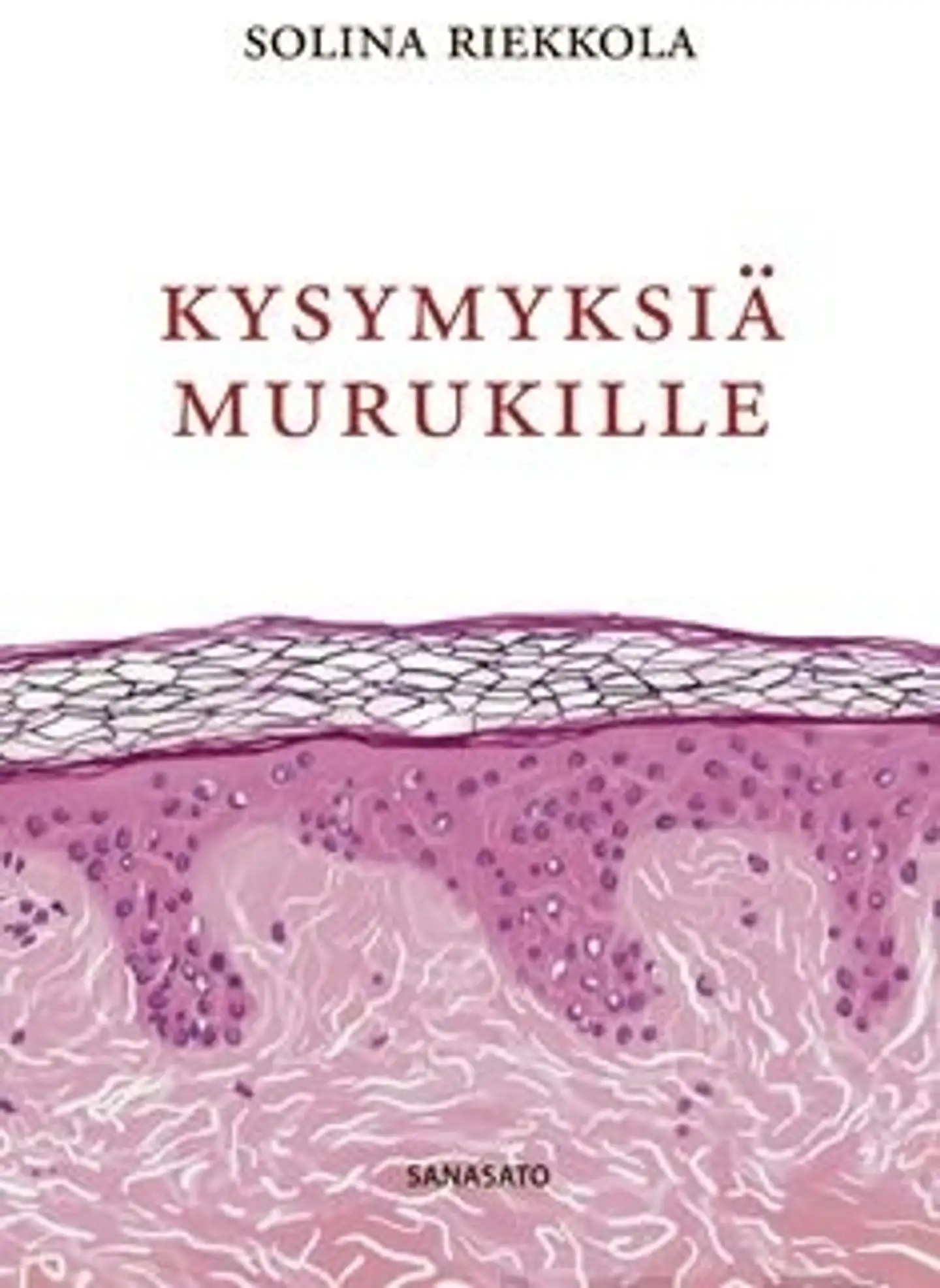 Riekkola, Kysymyksiä Murukille