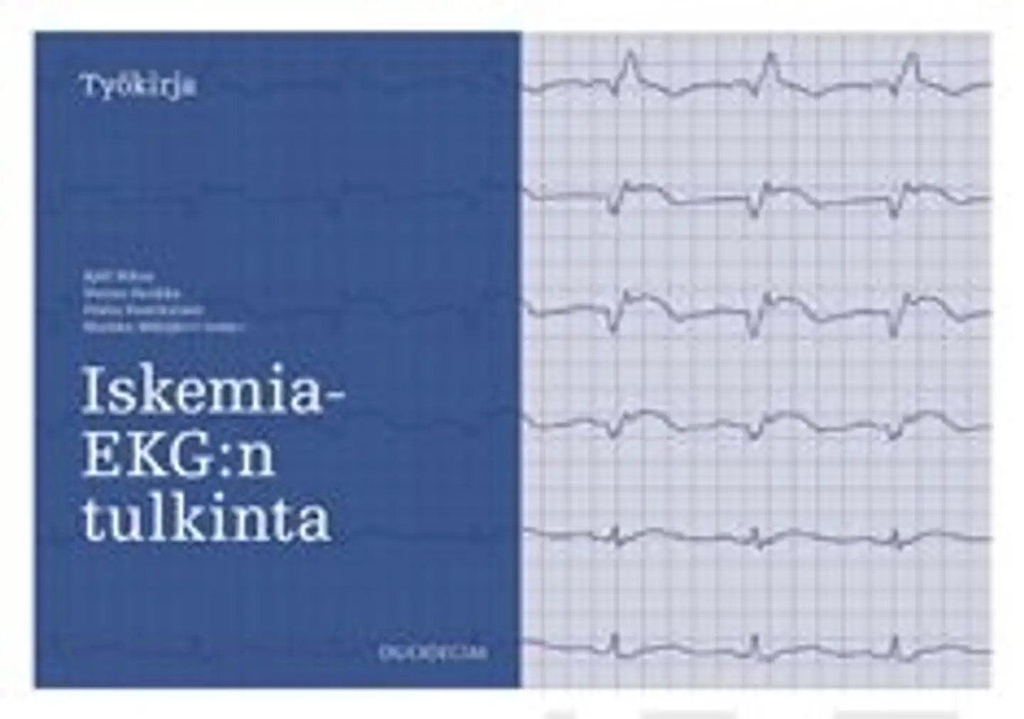 Iskemia-EKG:n tulkinta - Työkirja