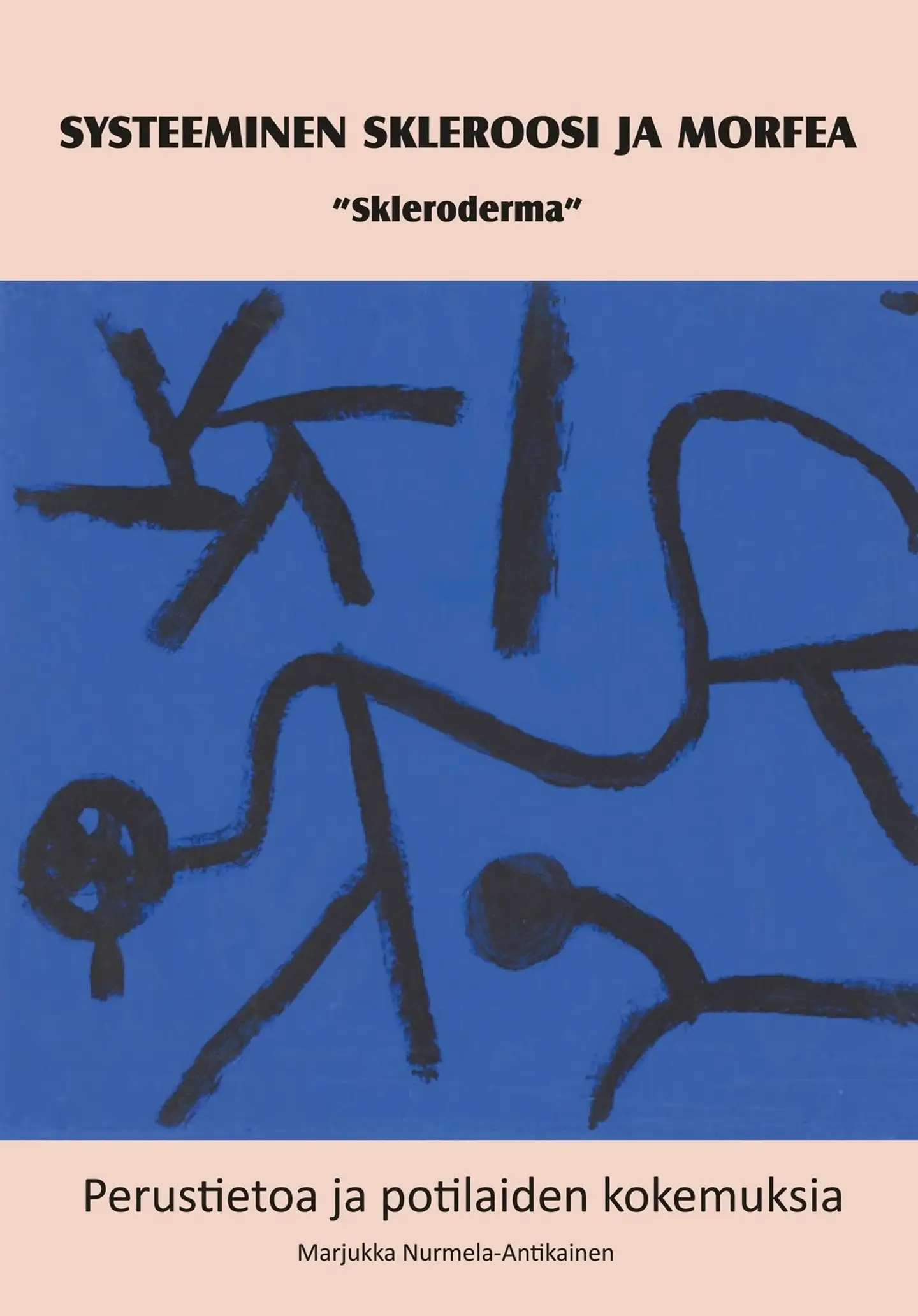 Nurmela-Antikainen, Systeeminen skleroosi ja morfea - "Skleroderma": perustietoa ja potilaiden kokemuksia