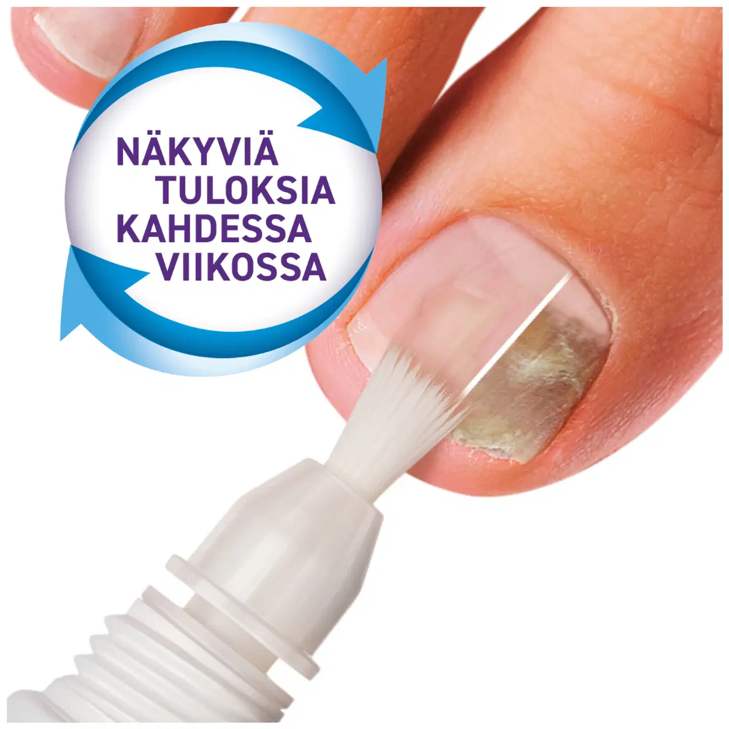 Mycosan Nail Kynsisienen hoitopakkaus 28g - 2