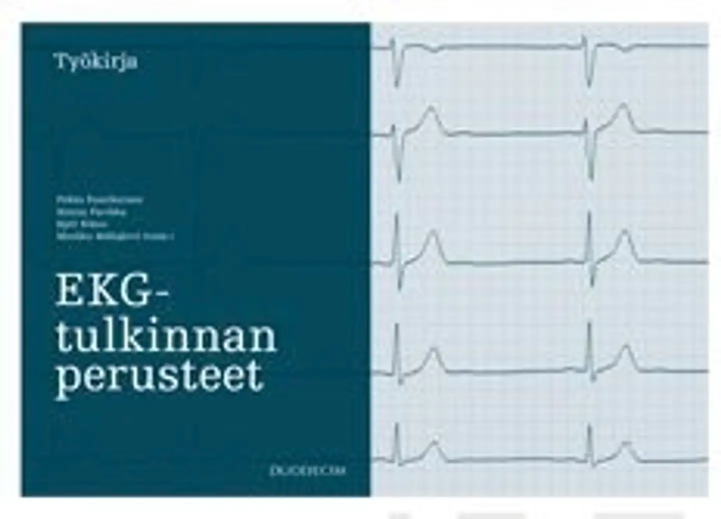 EKG-tulkinnan perusteet - Työkirja