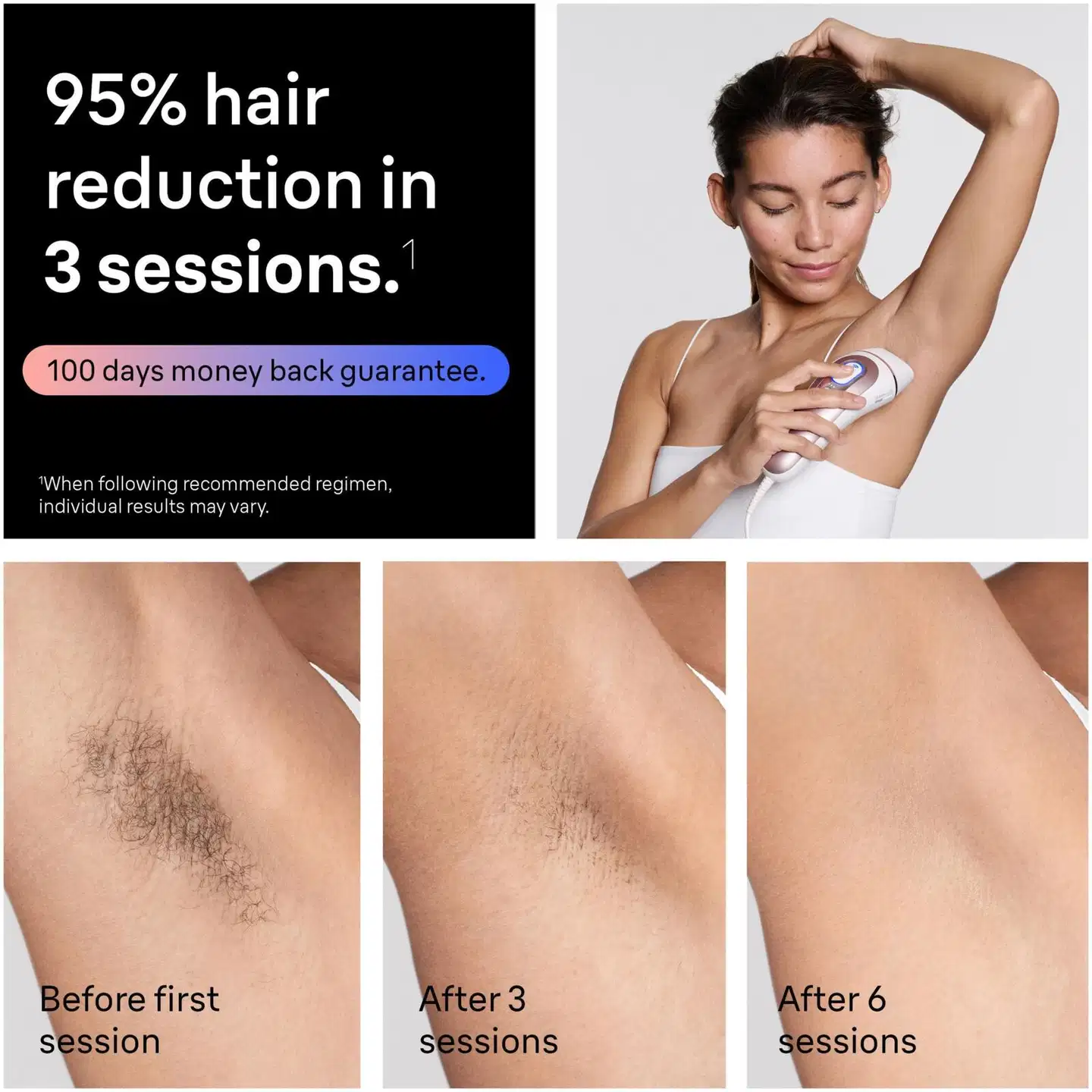 Braun Smart IPL Skin i·expert ihokarvanpoistolaite, 2 Smart-käsittelypäätä PL7211 - 4
