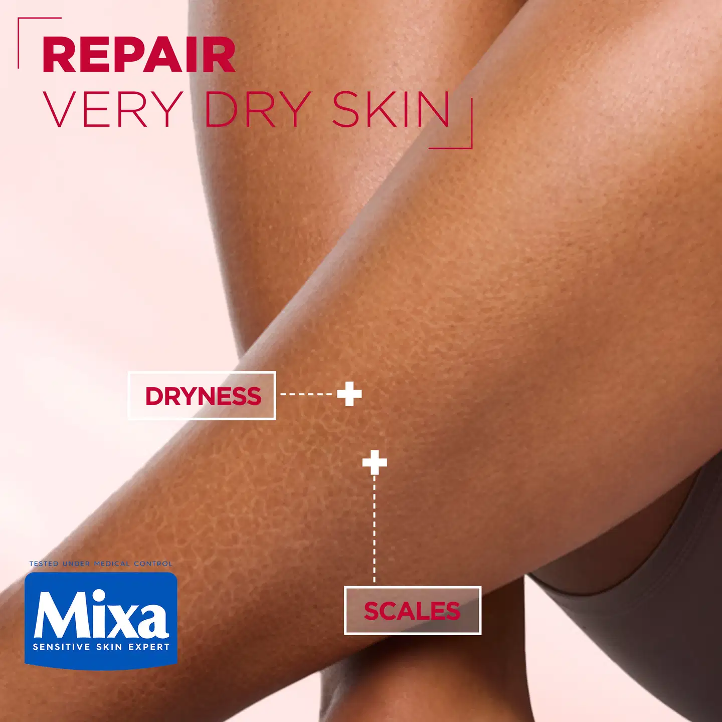 Mixa Urea Cica Repair Renewing Cream Ihoa uudistava voide kuivalle ja karhealle iholle 400ml - 4
