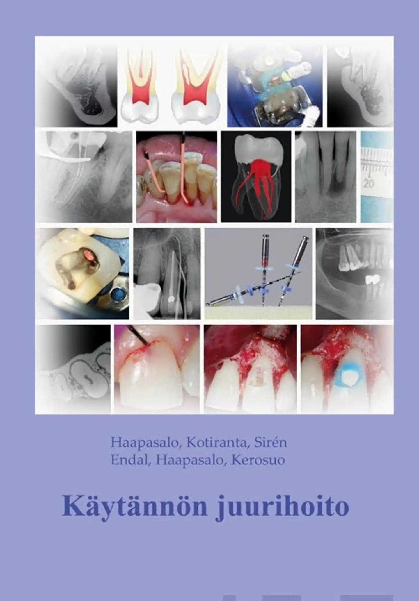 Haapasalo, Käytännön juurihoito