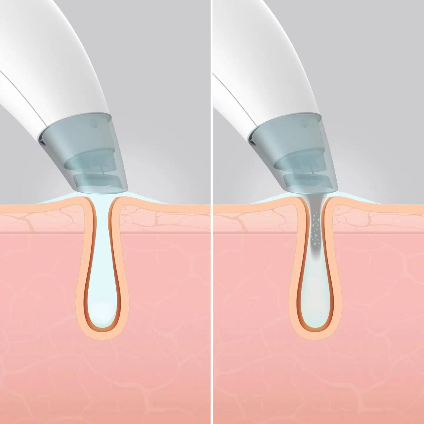 Homedics FAC-HY100 kasvojenpuhdistuslaite - 8