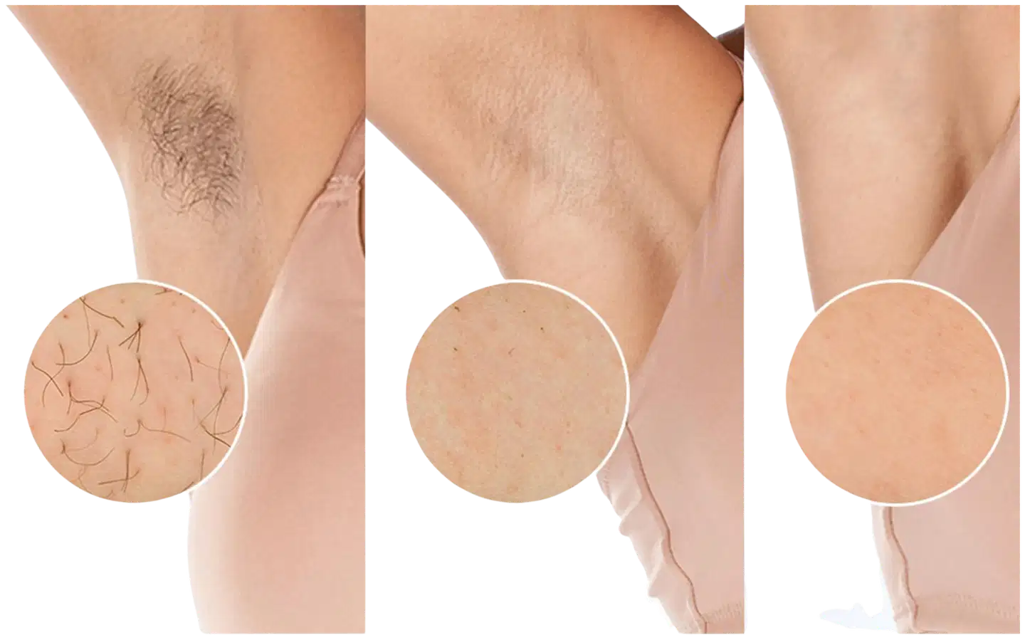 Philips Lumea IPL 8000 Series BRI946/00 karvanpoistolaite - 6