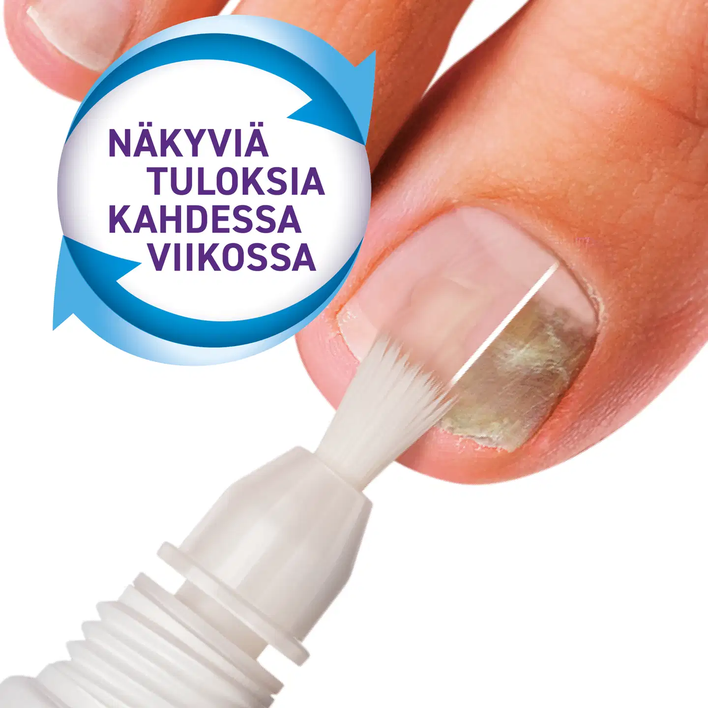 Mycosan Nail Kynsisienen hoitopakkaus 28g - 5