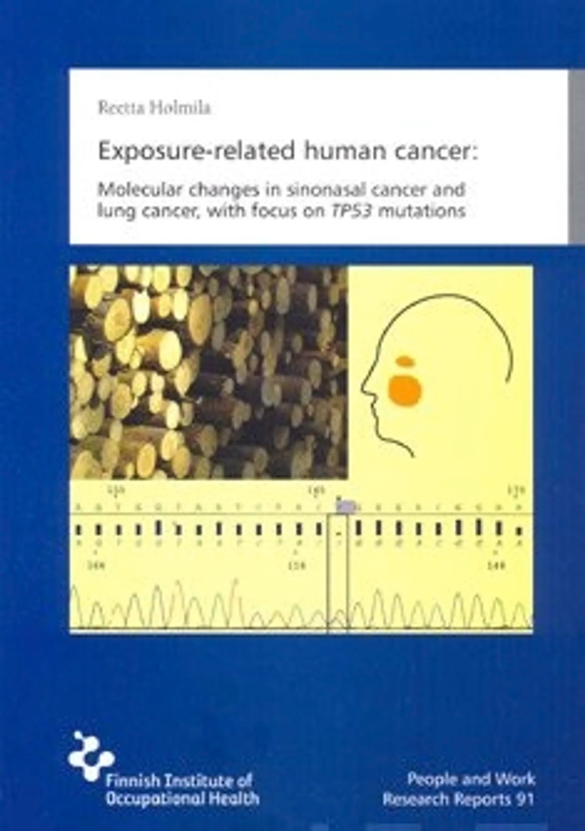 Exposure-related human cancer