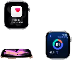 Apple Watch Series 11 GPS + Cellular 42mm kultatitaani kotelo, kultatitaani Milanese ranneke - MF8Y4QN/A - 3