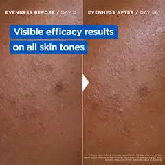 Mixa Niacinamide Bright Ravitseva voide tummia läiskiä vastaan, erittäin kuivalle iholle 400ml - 3