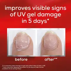 essie to the rescue kynsihoitotuote geelilakkauksen vaurioittamille kynsille 13,5 ml - 4