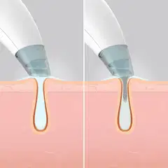 Homedics FAC-HY100 kasvojenpuhdistuslaite - 8