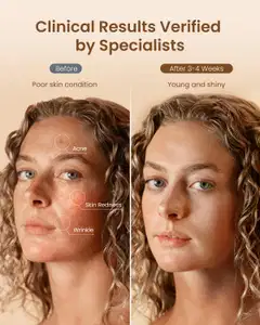 Renpho valonaamari Artimis Blush - 4