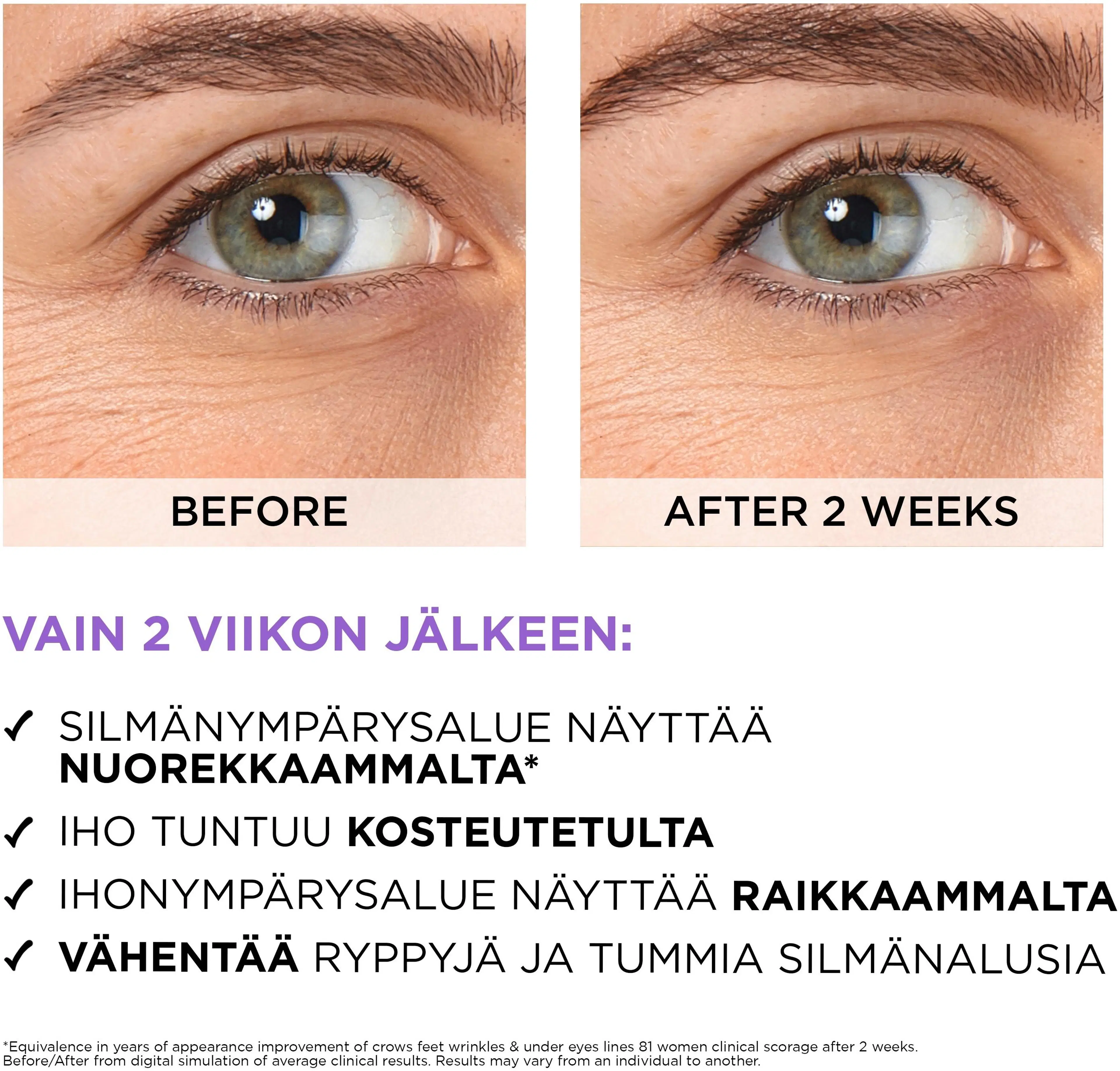 L'Oréal Paris Revitalift Filler 2,5% Hyaluronic Acid + Caffein Eye Serum silmänympärysalueelle 20 ml